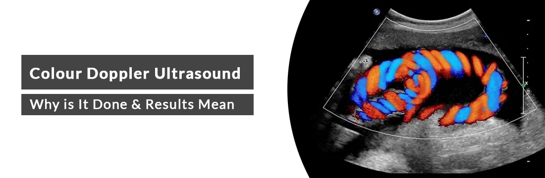 Colour Doppler Ultrasound Test During Pregnancy: Why is It Done, What Do the Results Mean